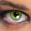 Queen’s solitaire Multifocale Torique Yellow